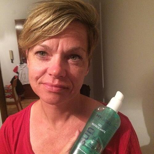 The best part of “after burn” cream is listening to Pam pronounce “aloe.” Its very soothing.